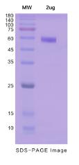 SDS-PAGE (MSR1-4609H).jpg